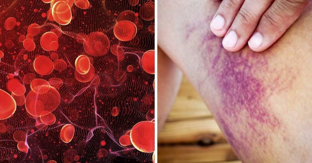 Curiosidades de salud: ¿por qué la sangre es de color rojo? - Porlavisión