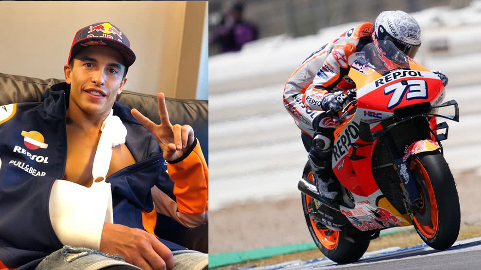 Marc Márquez, seis veces campeón de la MotoGP, será operado tras accidente