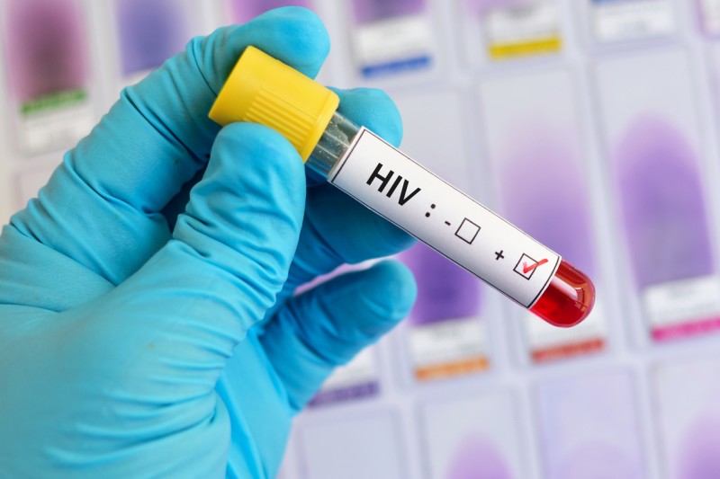 Vacuna contra el VIH podría venderse en 2024