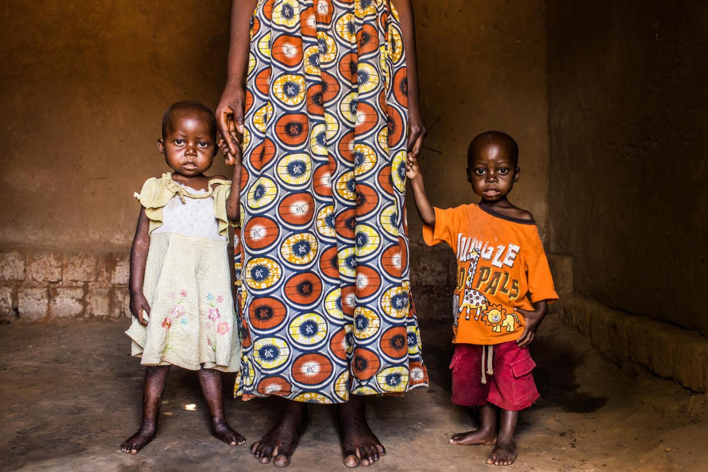 Unicef reveló que unos 3 millones de niños y niñas sufren desnutrición en Sudán